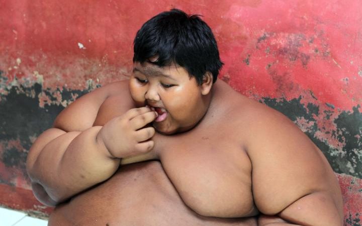 Niño más obeso del mundo 2