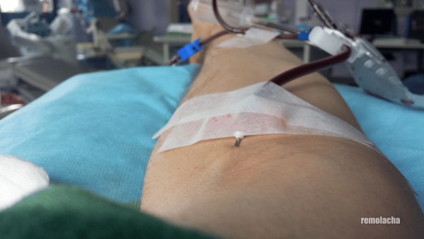 Plaquetas - donr sangre
