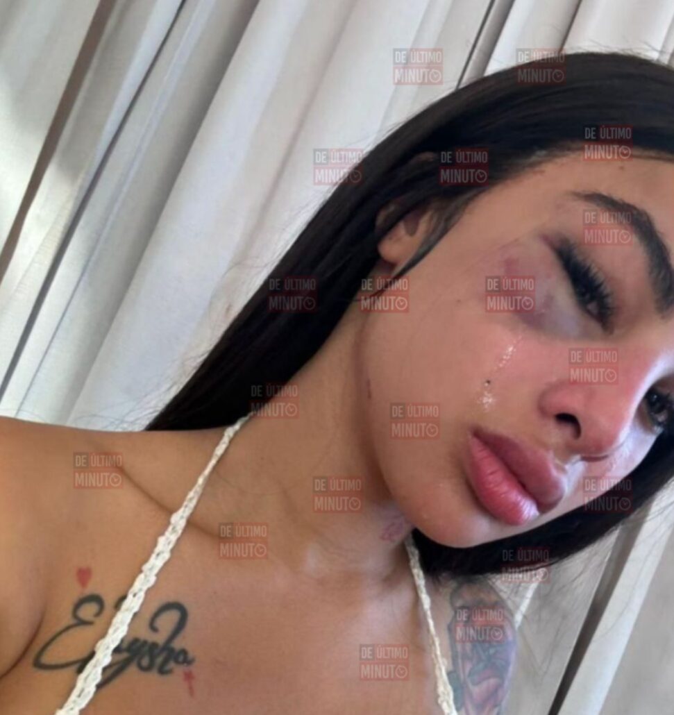 Yailin demanda a Tekashi por robo millonario y abuso doméstico - Remolacha - Noticias Republica Dominicana